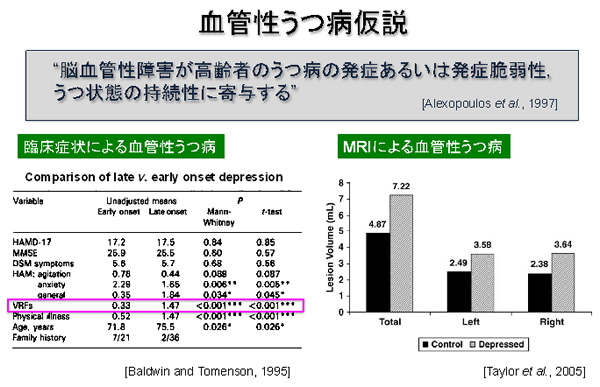 血管性うつ病仮説