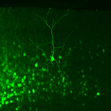 大脳皮質錐体細胞の樹状突起